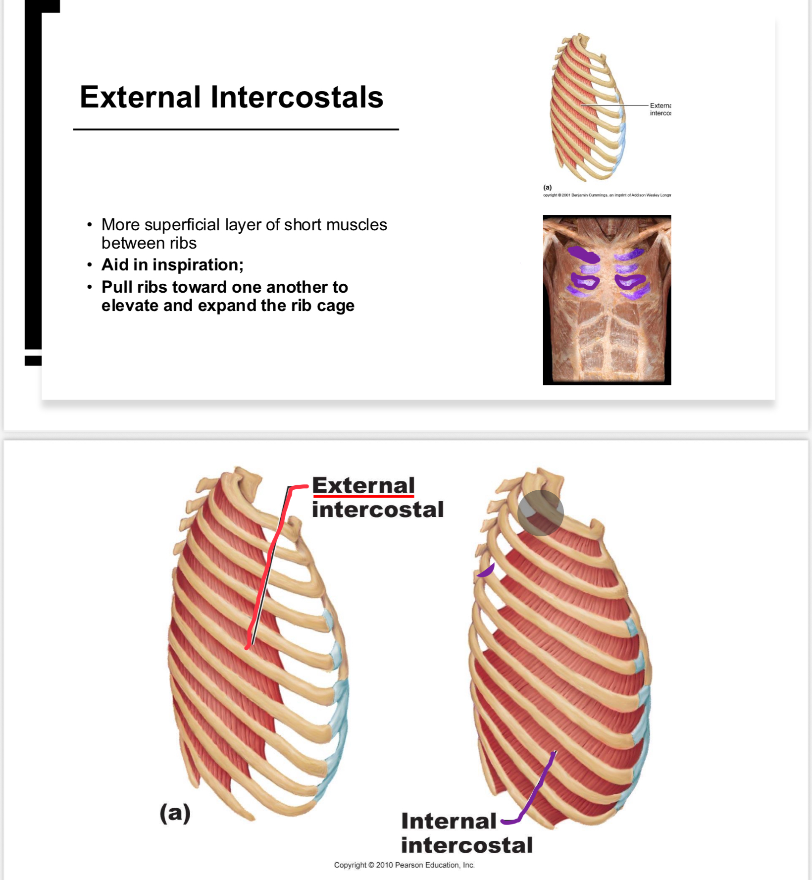 <p>Muscles that aid in inspiration by lifting ribs and expanding the thoracic cavity.</p>