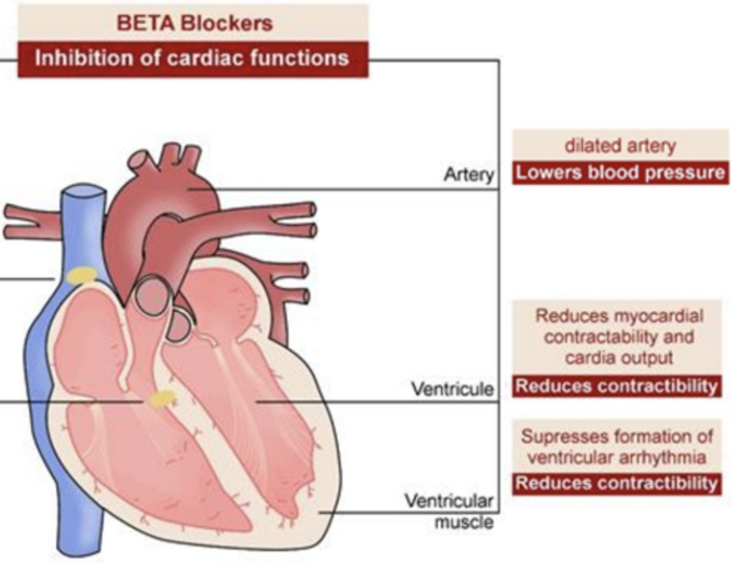 <p>supresses formation of ventricular arrhythmia</p><p>- reduces contractibility</p>