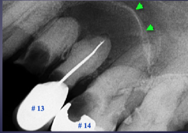 <p>what’s the pathology&nbsp;</p>