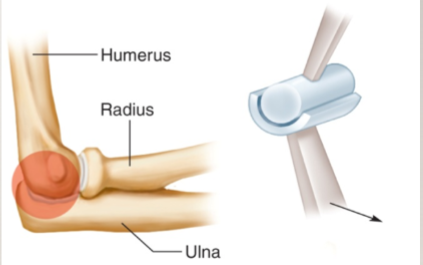<p>movement on a single plane </p><p>humerus and ulnar articulation only allows flexion/extension</p>