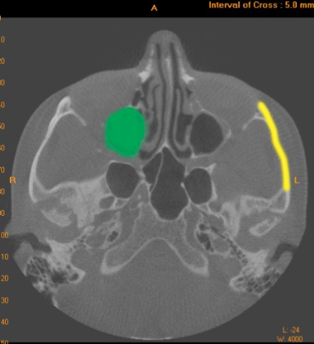<p>what is indicated by the <mark data-color="#79d92f" style="background-color: #79d92f; color: inherit">GREEN</mark> dot</p>