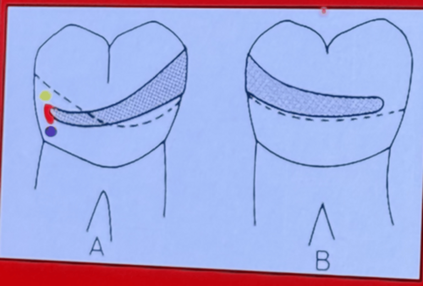 <p>reciprical/bracing arm</p>