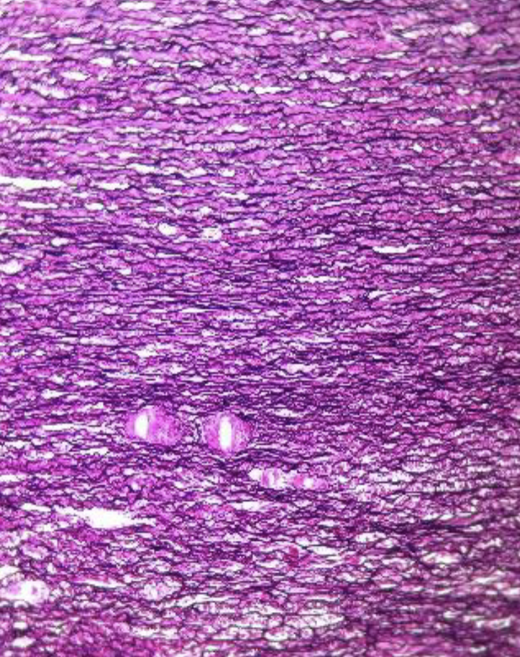 <ol><li><p><strong>Name the tissue type</strong></p></li><li><p><strong>Know where it is found in the body</strong></p></li><li><p><strong>Know its structure </strong></p></li><li><p><strong>what is the space  </strong></p></li></ol><p></p>