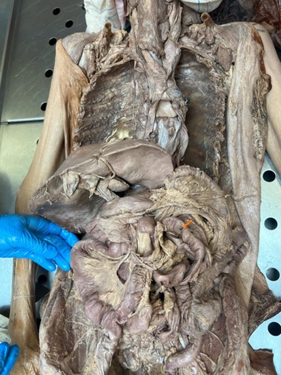 <p>jejunum</p>
