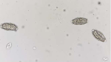 <p>indirect; earthworm is the intermediate host&nbsp;</p>