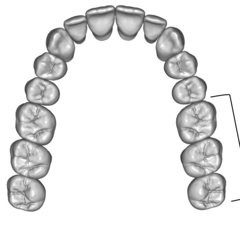 <p>What type of teeth are the lines pointing to&nbsp;</p>