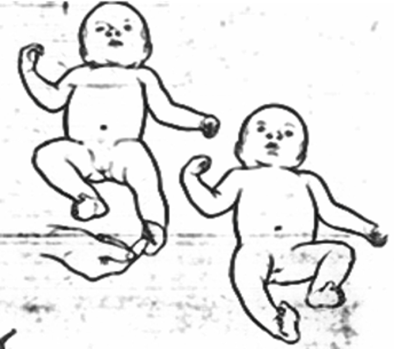 <p>noxious stim to sole of foot causes flexion then extension of contralateral leg.</p>