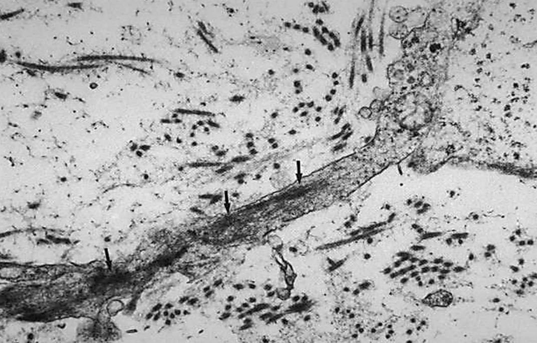 <p>Myofibroblasts</p>