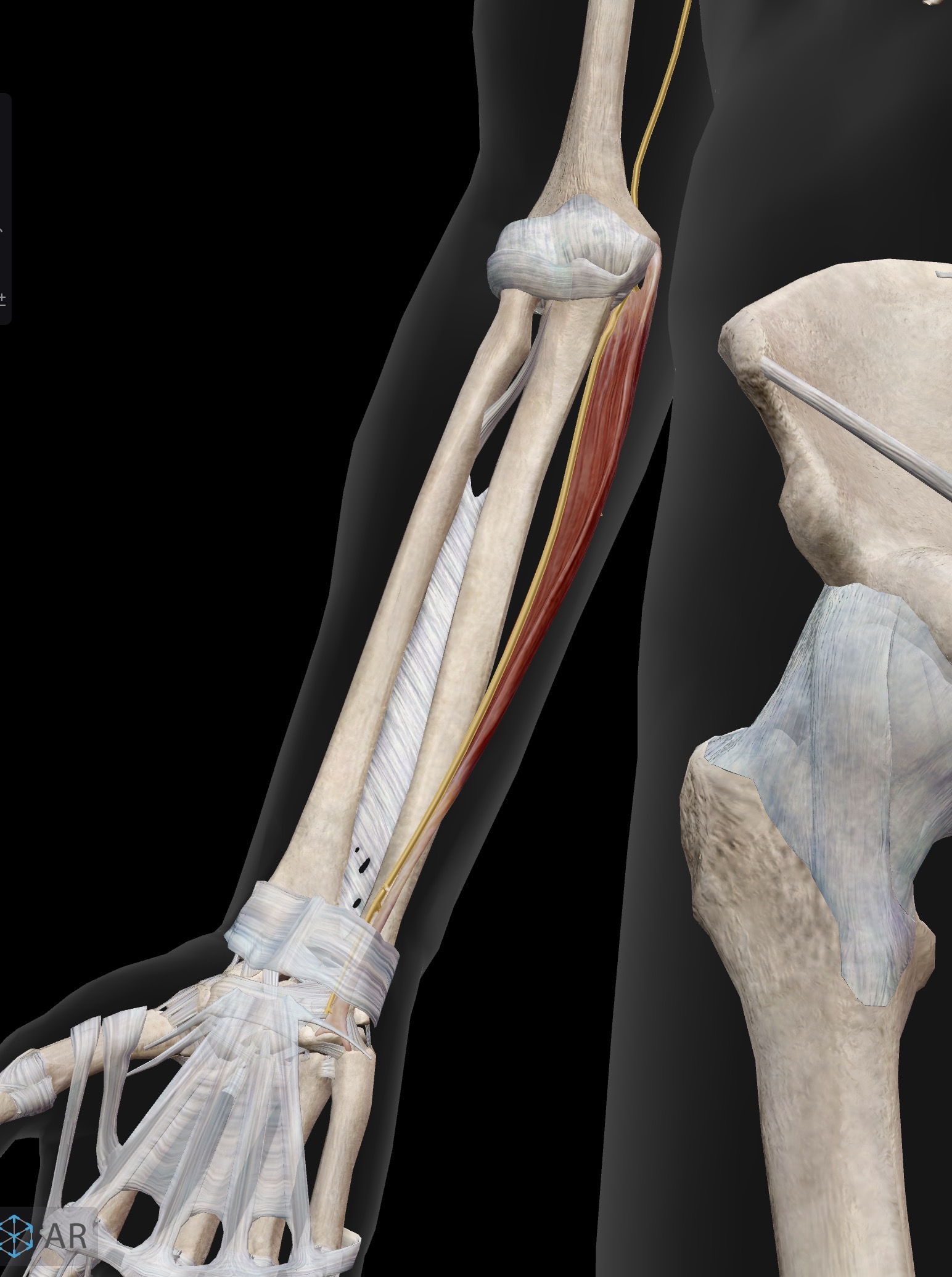 <p>Flexor carpi ulnaris</p><p>O: Medial epicondyle of the humerus (common flexor origin)</p><p>I: Pisiform, hook of the hamate and base of 5th metacarpal</p><p>A: Flexion and ulna deviation (adduction) of the hand at the wrist joint</p><p>IN: Ulnar nerve (C8, T1)</p>