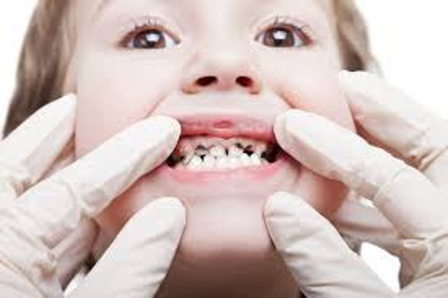 <p>I have a bad tooth</p>