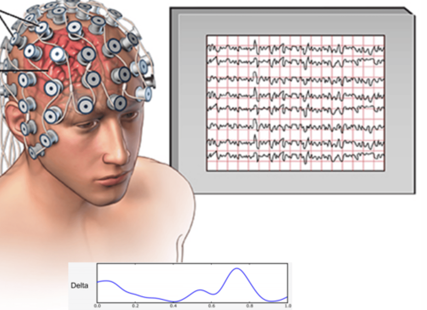 <p>Brain scan : electroencephalogram</p><p>an amplified recording of the waves of electrical activity sweeping across the brain's surface.</p><p>These waves are measured by electrodes placed on the scalp and gives a printout of brain activity as it happens</p><p>Sleep researchers use this to study someone's stages of sleep</p>