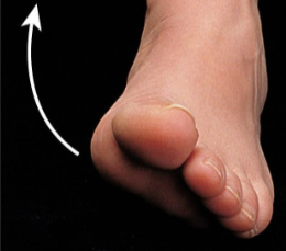 <p><span><span>Movement of the soles of the feet medially so they face each other. </span></span></p>