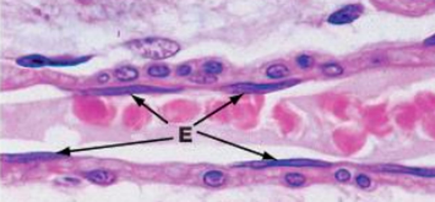 <p>classify this epithelial lining</p>