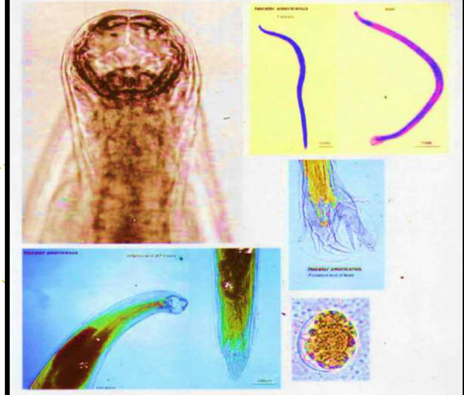 <p>Parasite under microscope?</p>