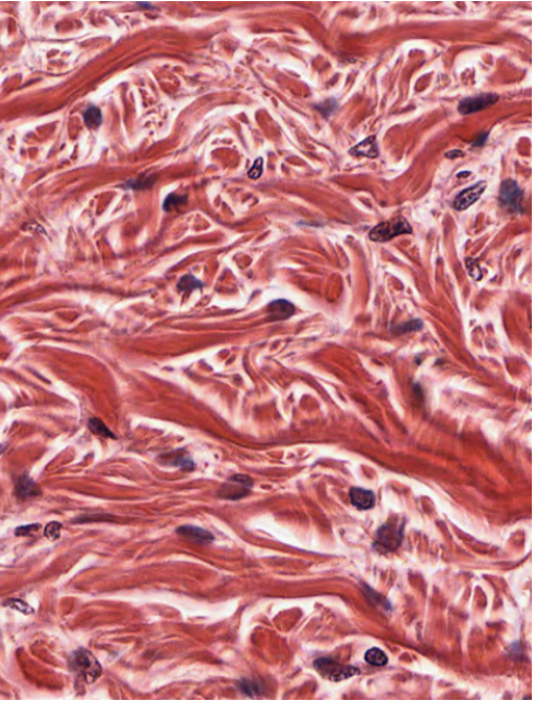 <p>What type of tissue is shown here?</p>