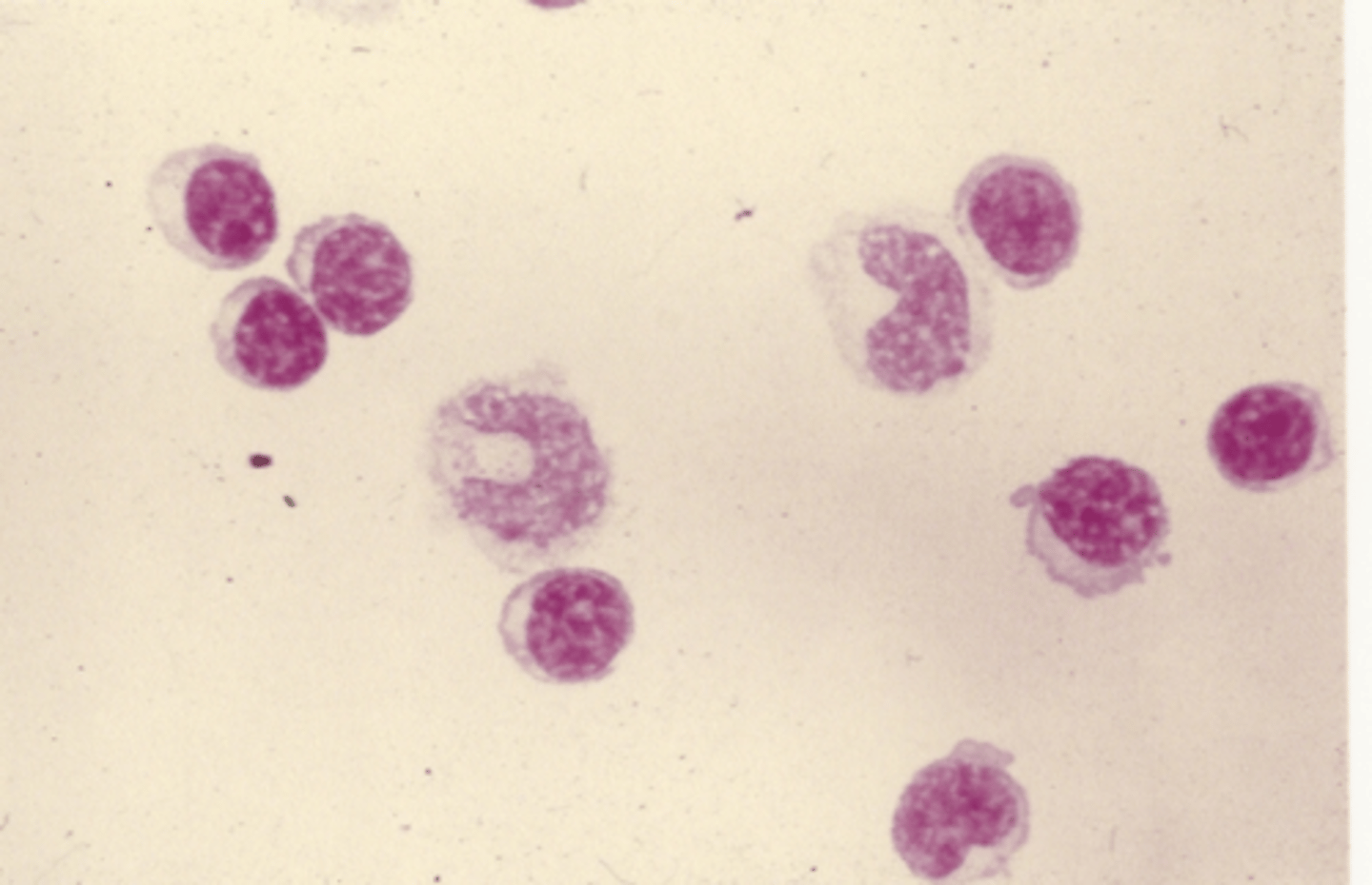<p>Identify the cells in this body fluid</p>