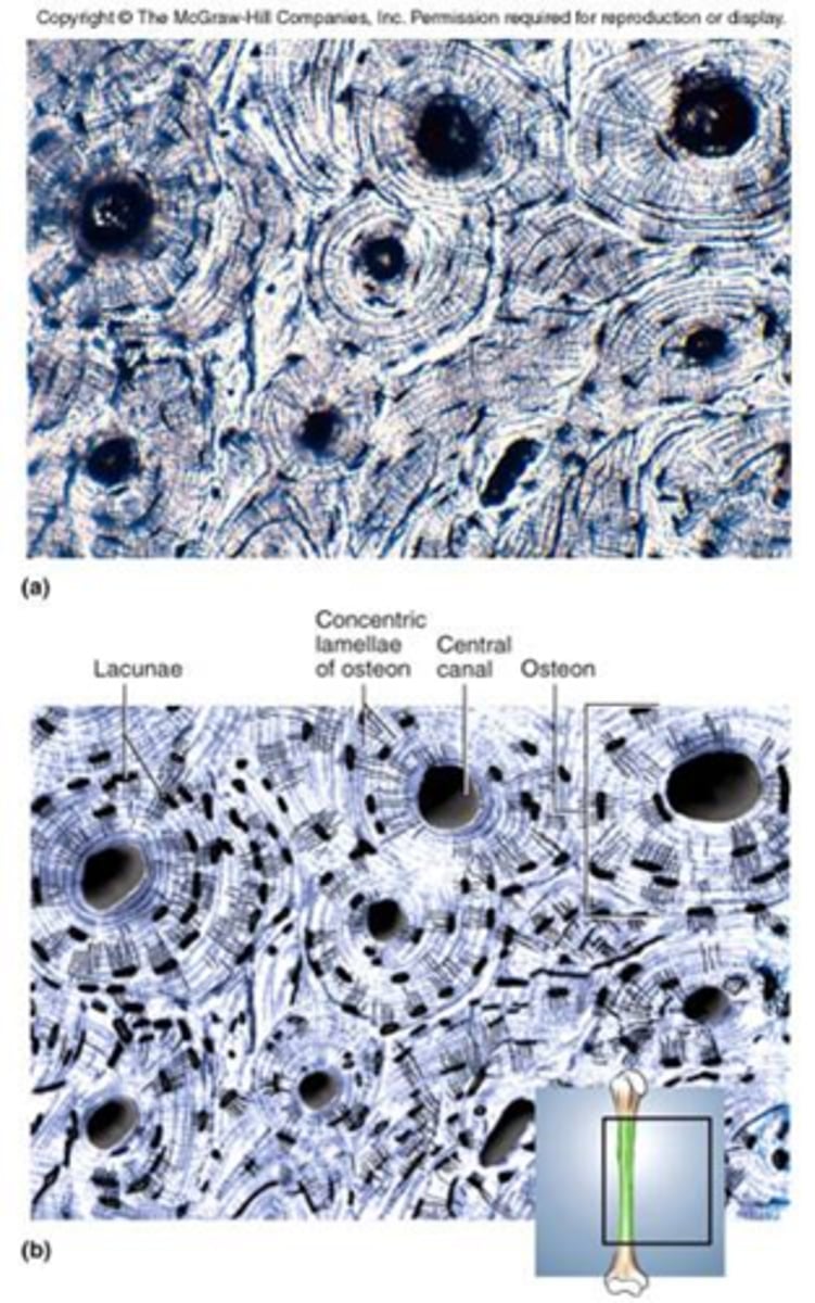 <p>A hard matrix that consists of collagen fibers and Ca++.</p><p>It functions to support and protect.</p><p>The cells are osteoblasts (they make the matrix) and osteocytes (which sit in lacunae and maintain the matrix in a healthy state).</p><p>It is very well vascularized.</p>