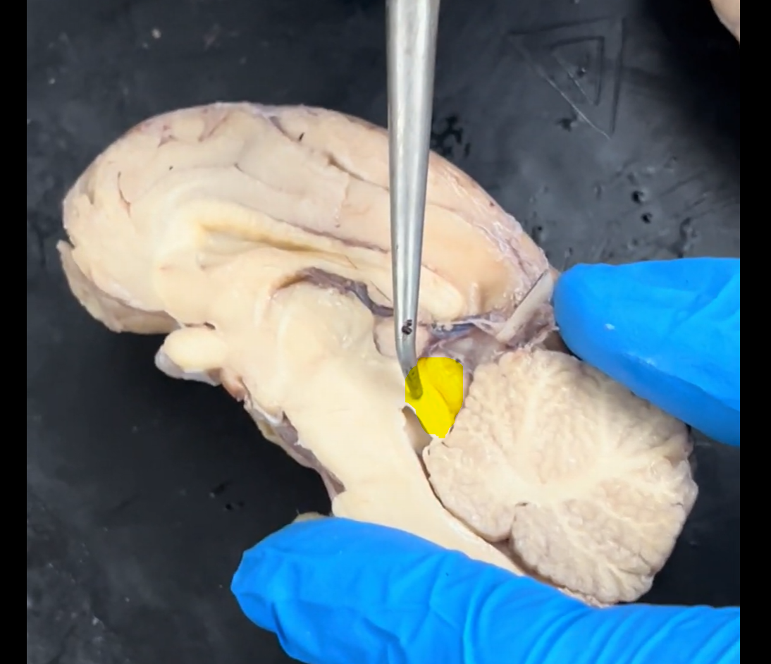 <p>When the two highlighted structures are combined with their matching structures on the other side of the midsagittal section, what structure is formed?</p>