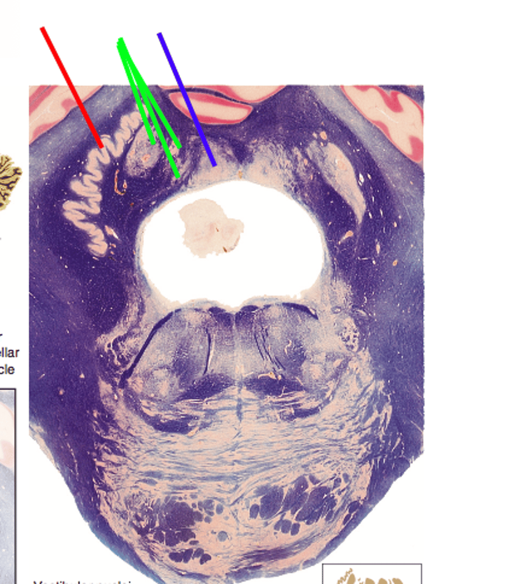 <p>In this image of the pons / cerebellum the colored areas are deep cerebellar nuclei ; match the color to the respective deep cerebellar nuclei</p>