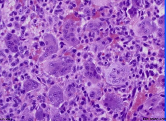 term image