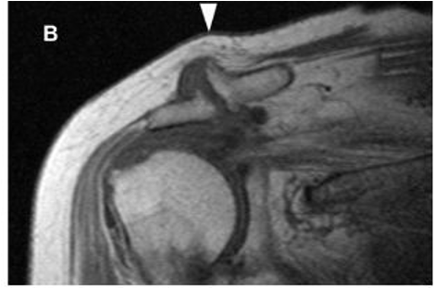 <p>What is this image depicting at the ACJ?</p>