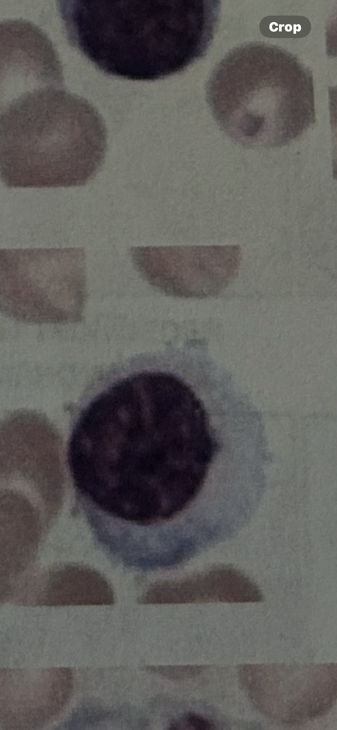 <p>WBC</p>
