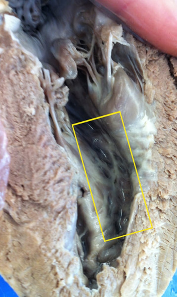 <p>bundles of muscle that force blood out of ventricles</p>