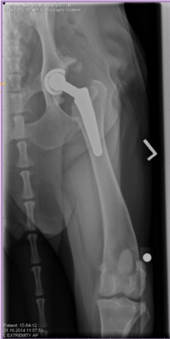 <p><span style="background-color: transparent;"><span>Total Hip Arthroplasty</span></span></p>