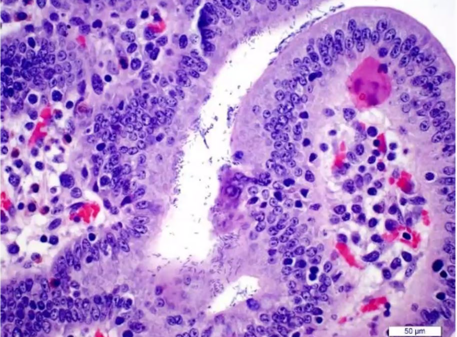 <p>Name of main toxins? </p>