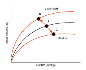 <p>downward and to the right– this decreases SV at any preload</p>