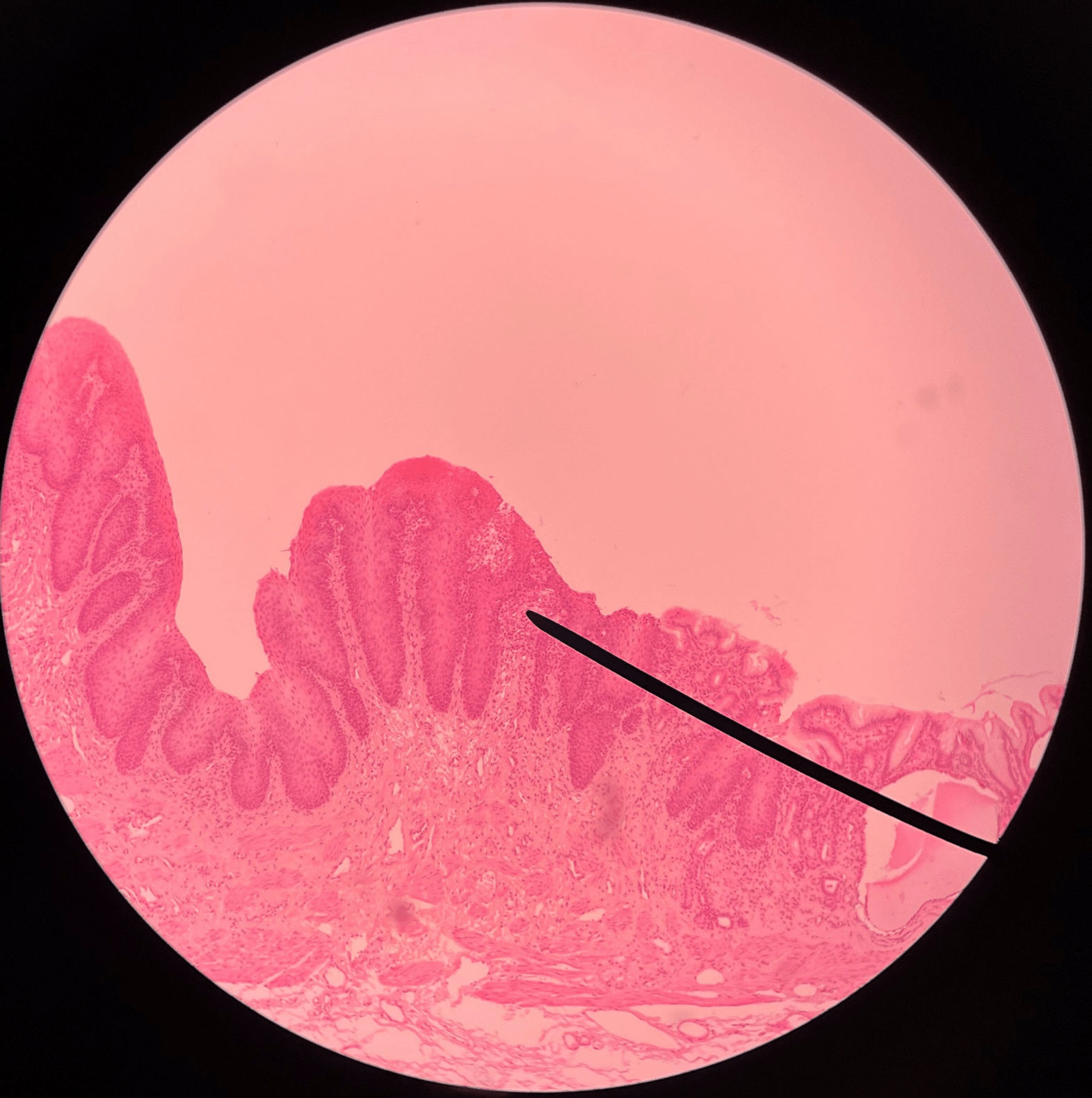 • Slide of the gastroesophageal junction.

• Composed of stratified squamous epithelium.