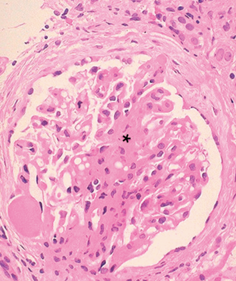 <p>What pathology is indicated?</p>