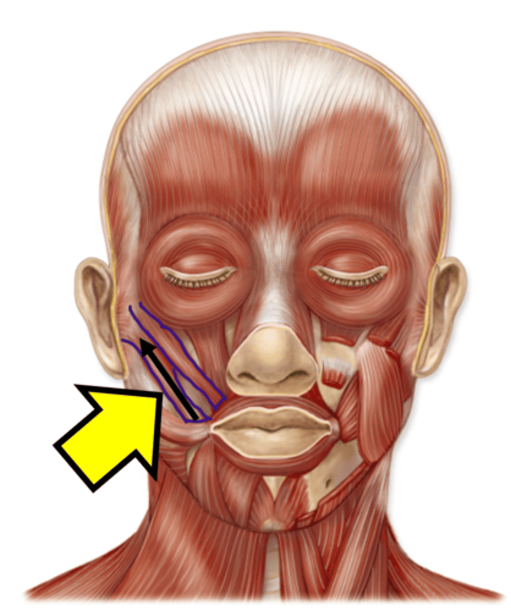 <p>Name the muscle</p>