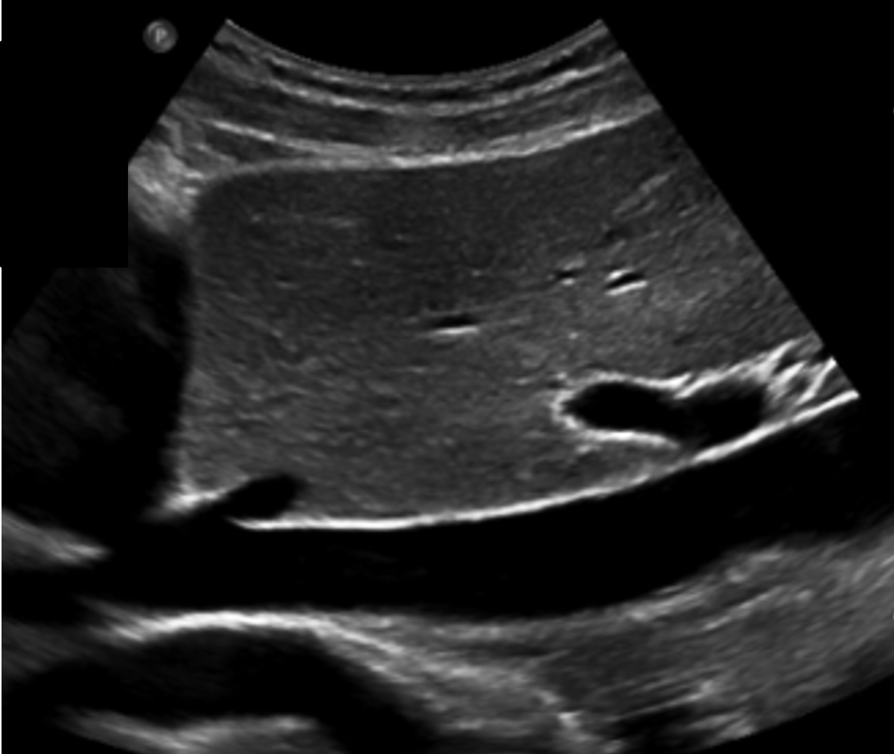 <p>In this sagittal plane, what is this structure?</p>