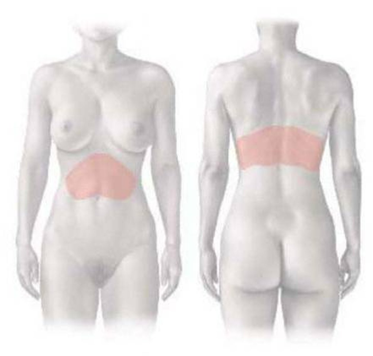 <p>referred pain of what structure?</p>