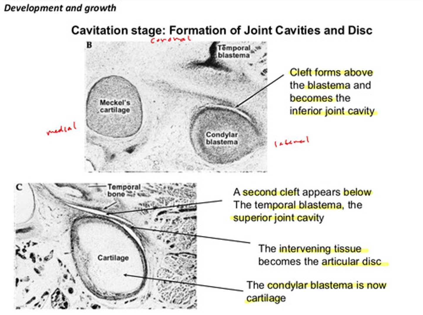 <p>is now cartilage</p>