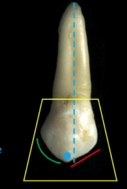 <p>distal</p>