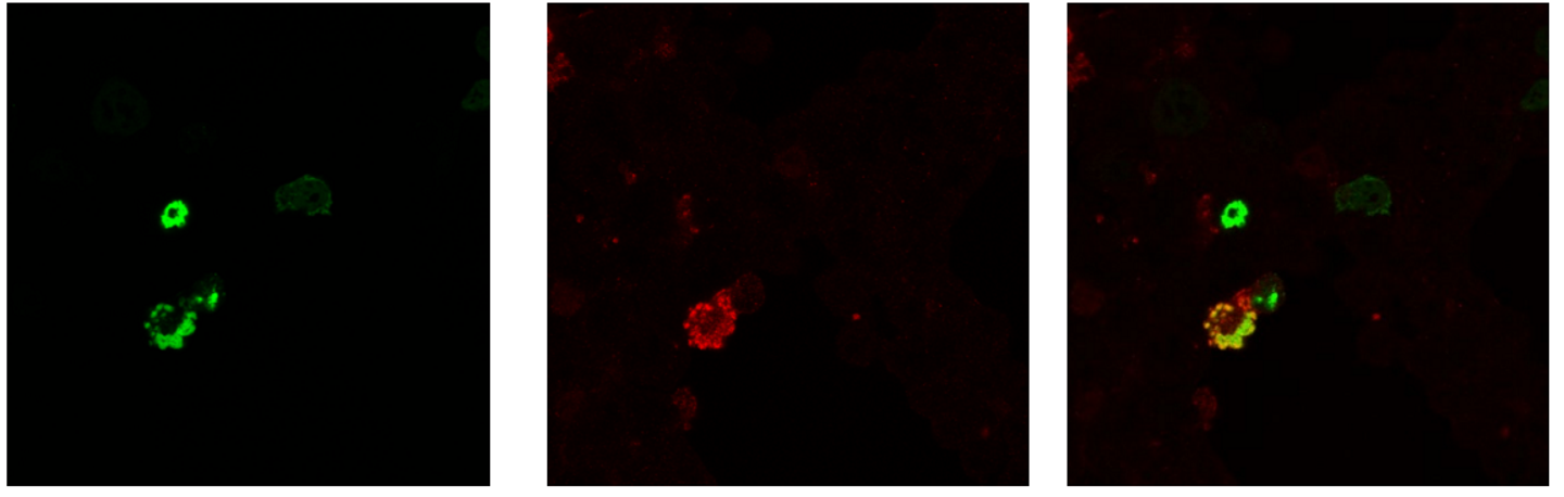 <p><strong><u>EARLY STAGE DETECTION</u></strong></p><p>assay <strong><em>endonuclease cleavage products</em></strong></p><ul><li><p><strong>TdT enzyme </strong>labels DNA strand breaks with fluorescent <strong>dUTP</strong></p></li><li><p>Detected by <strong>light microscopy</strong> or <strong>flow cytometry</strong>.</p></li><li><p>Highly sensitive but may give <strong>false positives</strong> (e.g. from necrosis or active gene transcription).</p></li></ul><p></p>