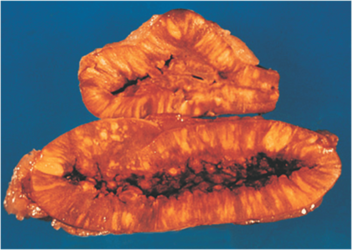 <p>Identify the pathology</p>