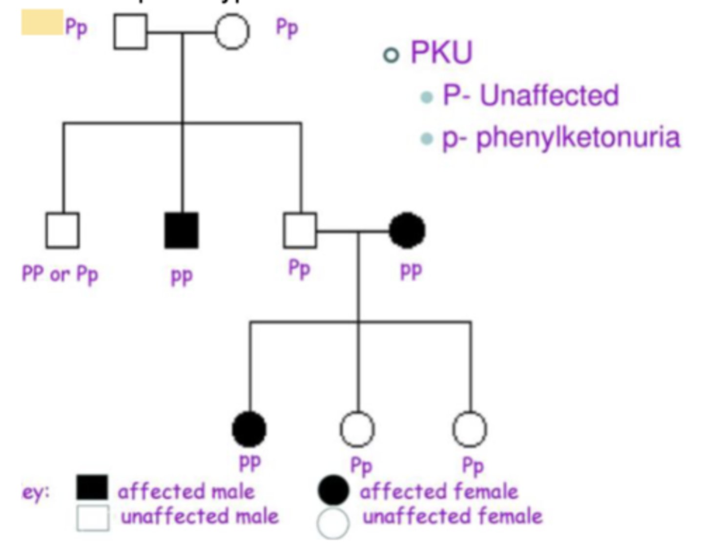 <p>A human metabolic disease caused by a mutation in a gene encoding a phenylalanine- processing enzyme, which leads to mental retardation if not treated; inherited as an autosomal recessive phenotype.</p>
