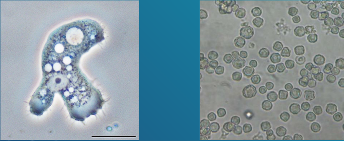 <ul><li><p>It usually causes infection in immunocompromised patients.</p></li><li><p>It is a free-living amoeba that causes inflammation of the brain substance and its meningeal coverings (meningoencephalitis)</p></li><li><p>Found widely in soil, contaminated freshwater lakes, and other water environment</p></li><li><p>It is able to survive in cold water</p></li><li><p>Infective stage is the cyst; wjile pathogenic stage is the trophozoite</p><p></p></li></ul><p></p>
