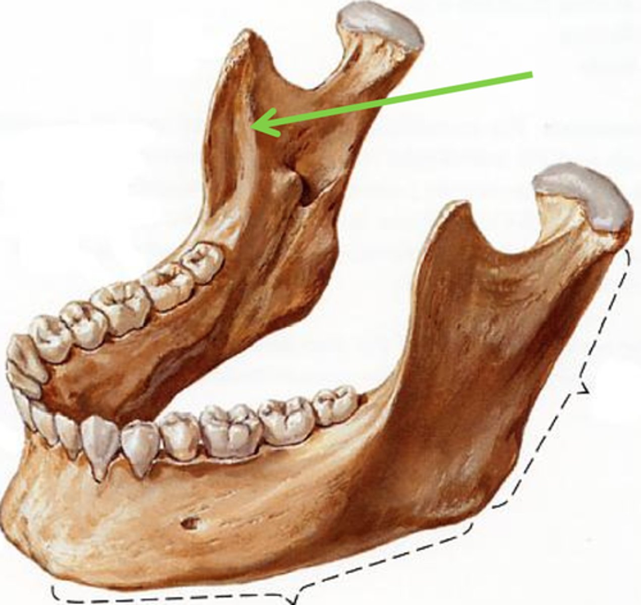 <p>(mylohyoid ridge) follows the inside of the ramus and the body of the mandible.</p>