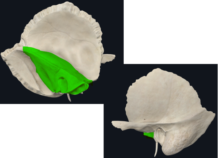 <p>Peñasco, roca</p><ul><li><p>resistente y fuerte</p></li><li><p>forma de pirámide cuadrangular</p></li></ul><p></p><p>Posteroinferior con fosa yugular</p><p>Anterior con tegmen timpani y el ala mayor del esfenoide</p><p>Anterosuperior: inicia el acueducto de falopio en el hiato del conducto del nervio petroso mayor</p><p>Base: conducto auditivo externo</p><p>Vértice termina con el conducto carotideo</p>