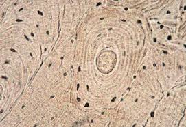 <p>A type of specialized connective tissue that provides structural support and protection to the body, consisting of a hard matrix mineralized with calcium phosphate and collagen fibers. </p>