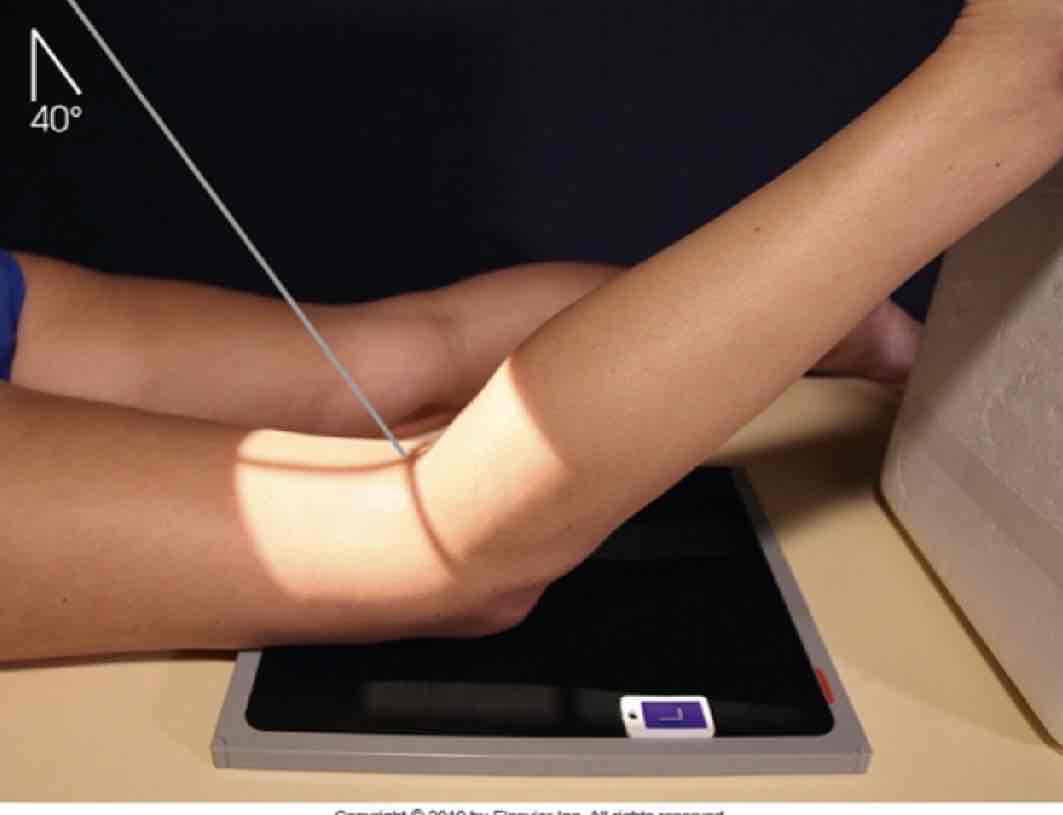 <p>What Projection is this?</p>