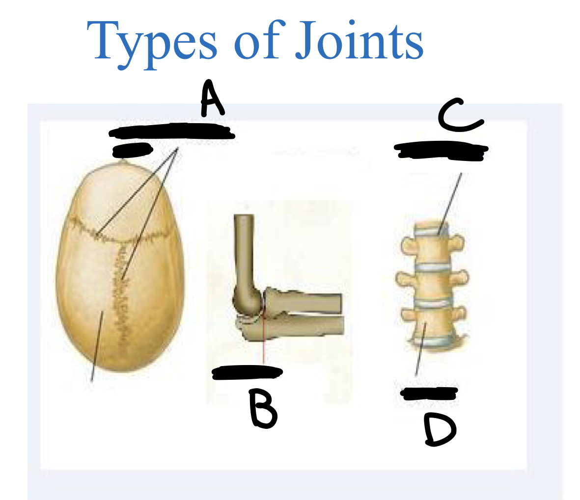 <p>A. fixed/unmoveable joint</p><p>B. flexible joint</p><p>C. semi flexible joint</p><p>D. vertebrae</p>