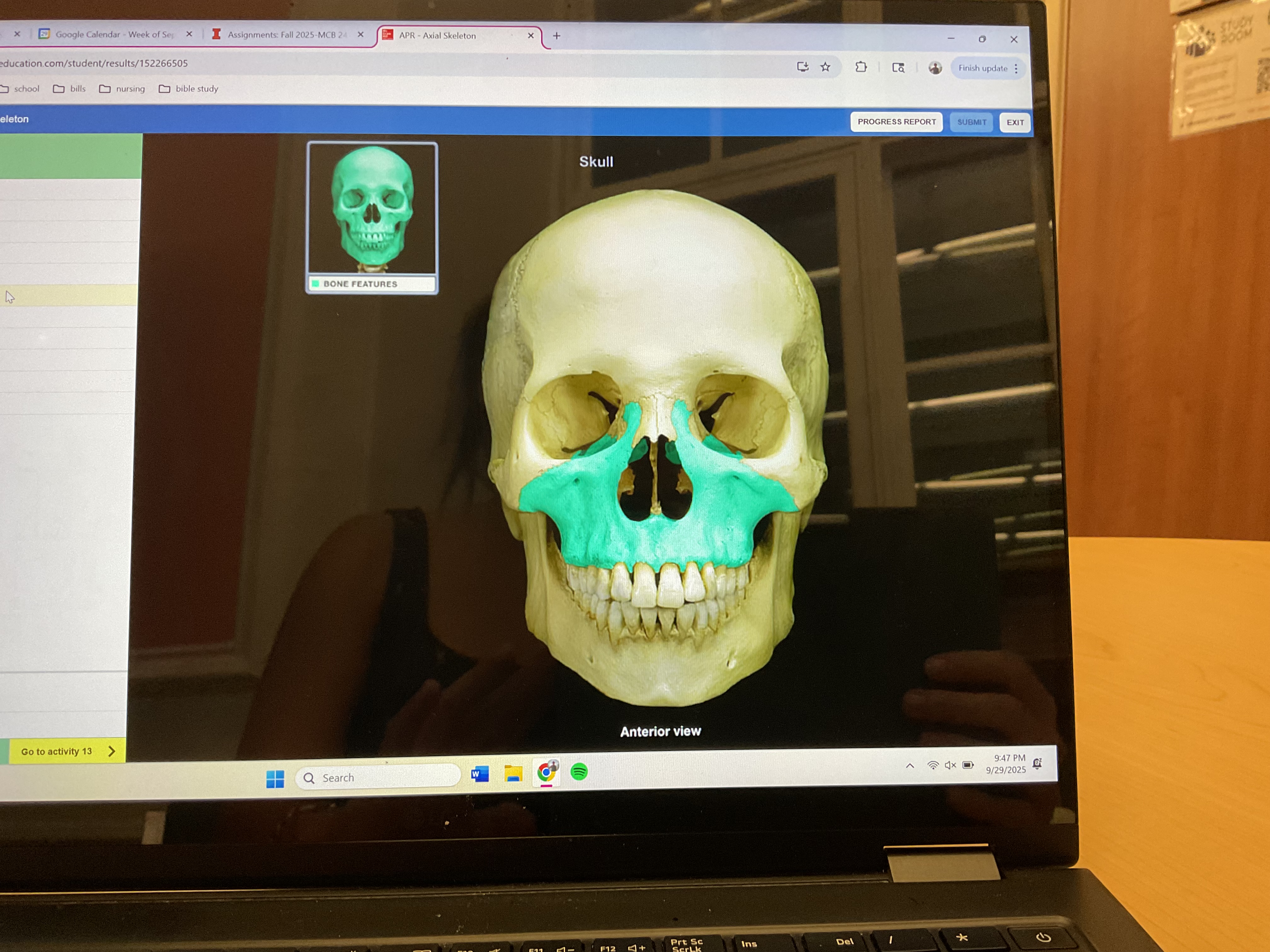<p>Maxilla </p>