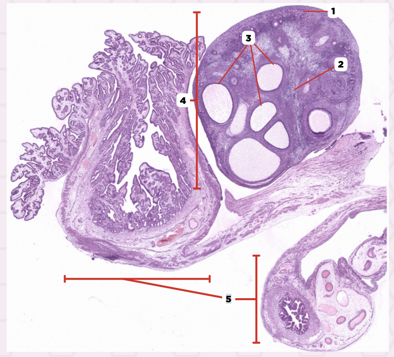 <p>Identify the structure labeled as 1.</p>