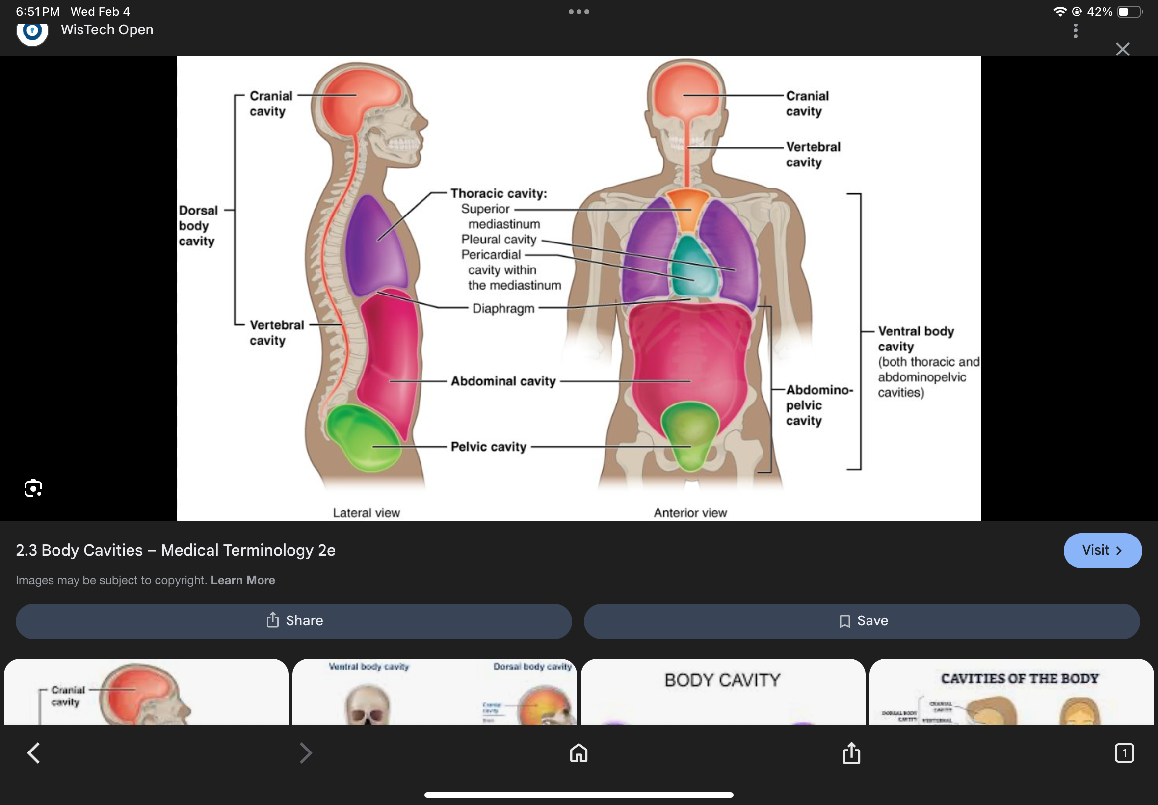 <p>The cavity inferior to the diaphragm containing abdominal and pelvic cavities.</p>