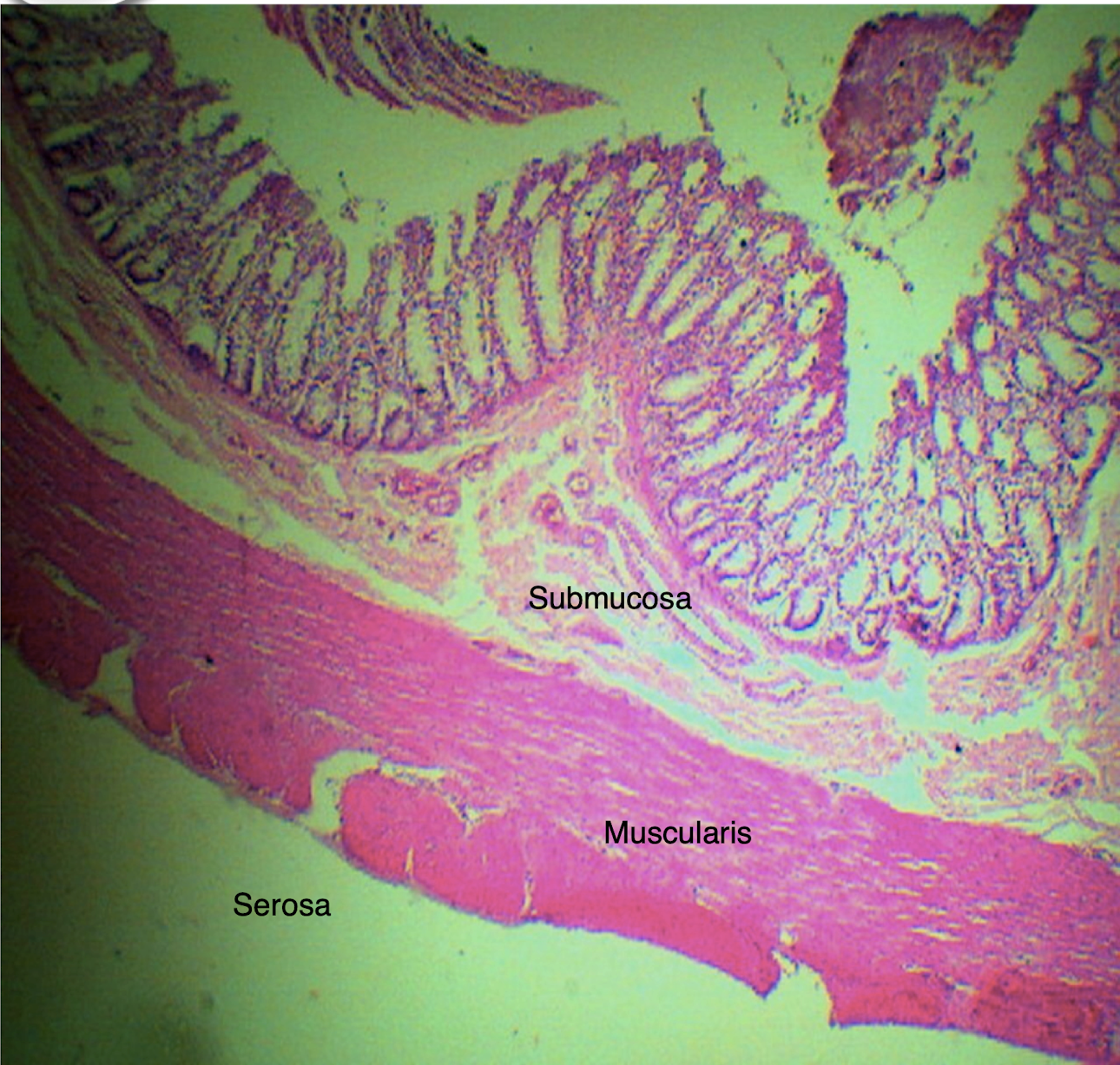 <p>T/F: Crypts of Lieberkuhn are still present and usually longer and straighter than that of small intestine</p>